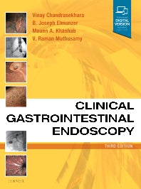 Clinical Gastrointestinal Endoscopy (Hardback) 9780323415095