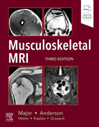 Musculoskeletal MRI (Hardback) 9780323415606