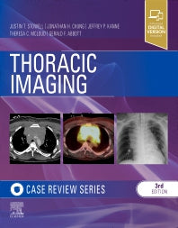 Thoracic Imaging: Case Review (Paperback / softback) 9780323428798