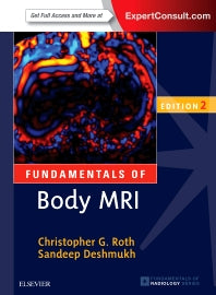 Fundamentals of Body MRI (Paperback / softback) 9780323431415