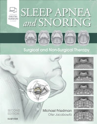 Sleep Apnea and Snoring; Surgical and Non-Surgical Therapy (Hardback) 9780323443395
