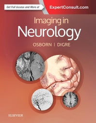 Imaging in Neurology (Hardback) 9780323447812