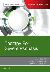 Therapy for Severe Psoriasis (Hardback) 9780323447973