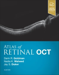 Atlas of Retinal OCT: Optical Coherence Tomography (Hardback) 9780323461214