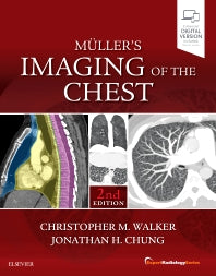 Muller's Imaging of the Chest; Expert Radiology Series (Hardback) 9780323462259
