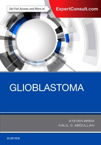 Glioblastoma (Hardback) 9780323476607