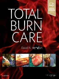 Total Burn Care (Hardback) 9780323476614