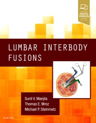 Lumbar Interbody Fusions (Hardback) 9780323476638