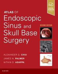 Atlas of Endoscopic Sinus and Skull Base Surgery (Hardback) 9780323476645