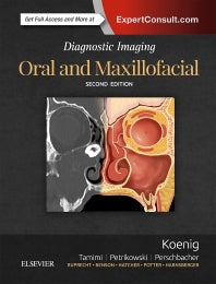 Diagnostic Imaging: Oral and Maxillofacial (Hardback) 9780323477826