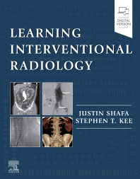 Learning Interventional Radiology (Paperback / softback) 9780323478793