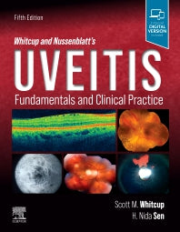 Whitcup and Nussenblatt's Uveitis; Fundamentals and Clinical Practice (Hardback) 9780323480147