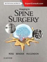 Imaging in Spine Surgery (Hardback) 9780323485548