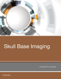 Skull Base Imaging (Hardback) 9780323485630