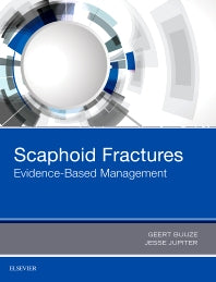 Scaphoid Fractures; Evidence-Based Management (Hardback) 9780323485647