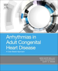 Arrhythmias in Adult Congenital Heart Disease; A Case-Based Approach (Paperback / softback) 9780323485685