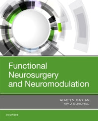 Functional Neurosurgery and Neuromodulation (Paperback / softback) 9780323485692