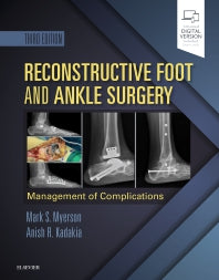 Reconstructive Foot and Ankle Surgery: Management of Complications (Hardback) 9780323496933