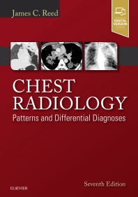 Chest Radiology; Patterns and Differential Diagnoses (Hardback) 9780323498319