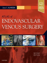 Atlas of Endovascular Venous Surgery (Hardback) 9780323511391