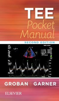 TEE Pocket Manual (Paperback / softback) 9780323522809