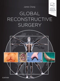 Global Reconstructive Surgery (Hardback) 9780323523776