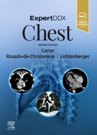 ExpertDDx: Chest (Hardback) 9780323524827