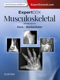 ExpertDDx: Musculoskeletal (Hardback) 9780323524834