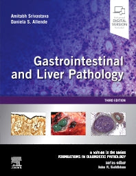 Gastrointestinal and Liver Pathology; A Volume in the Series: Foundations in Diagnostic Pathology (Hardback) 9780323527941