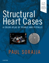 Structural Heart Cases; A Color Atlas of Pearls and Pitfalls (Hardback) 9780323546959