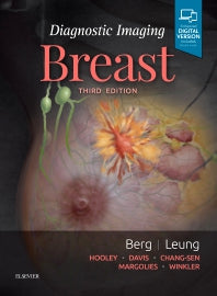 Diagnostic Imaging: Breast (Hardback) 9780323548120
