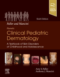 Paller and Mancini - Hurwitz Clinical Pediatric Dermatology; A Textbook of Skin Disorders of Childhood & Adolescence (Hardback) 9780323549882