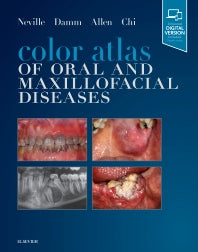 Color Atlas of Oral and Maxillofacial Diseases (Hardback) 9780323552257