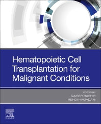 Hematopoietic Cell Transplantation for Malignant Conditions (Paperback / softback) 9780323568029