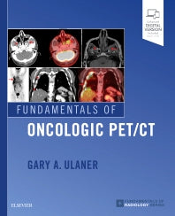 Fundamentals of Oncologic PET/CT (Paperback / softback) 9780323568692