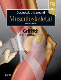 Diagnostic Ultrasound: Musculoskeletal (Hardback) 9780323570138
