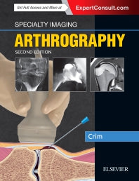 Specialty Imaging: Arthrography (Hardback) 9780323594899