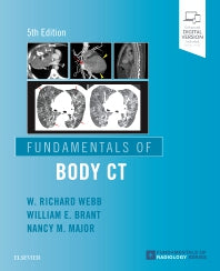 Fundamentals of Body CT (Paperback / softback) 9780323608329