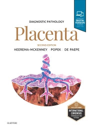 Diagnostic Pathology: Placenta (Hardback) 9780323609715