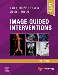 Image-Guided Interventions; Expert Radiology Series (Hardback) 9780323612043