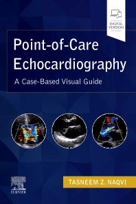 Point-of-Care Echocardiography; A Clinical Case-Based Visual Guide (Paperback / softback) 9780323612845