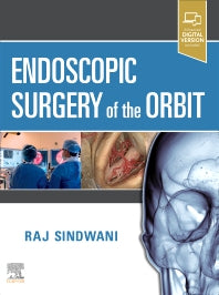 Endoscopic Surgery of the Orbit (Hardback) 9780323613293