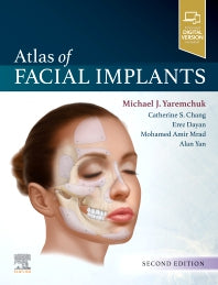 Atlas of Facial Implants (Hardback) 9780323624763