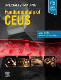 Specialty Imaging: Fundamentals of CEUS (Hardback) 9780323625647