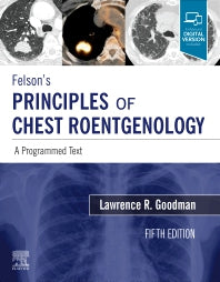 Felson's Principles of Chest Roentgenology, A Programmed Text; A Programmed Text (Paperback / softback) 9780323625678