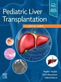 Pediatric Liver Transplantation; A Clinical Guide (Hardback) 9780323636711