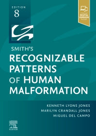 Smith's Recognizable Patterns of Human Malformation (Hardback) 9780323638821