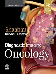 Diagnostic Imaging: Oncology (Hardback) 9780323661126