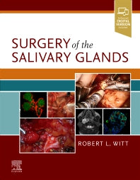Surgery of the Salivary Glands (Hardback) 9780323672368