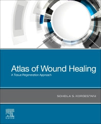 Atlas of Wound Healing; A Tissue Regeneration Approach (Paperback / softback) 9780323679688